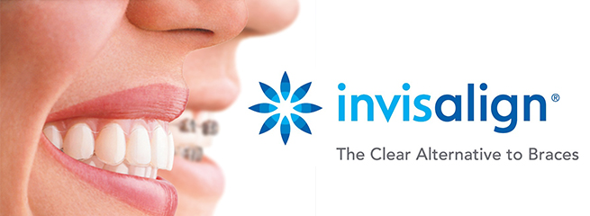invisalign clear braces aligners indianapolis