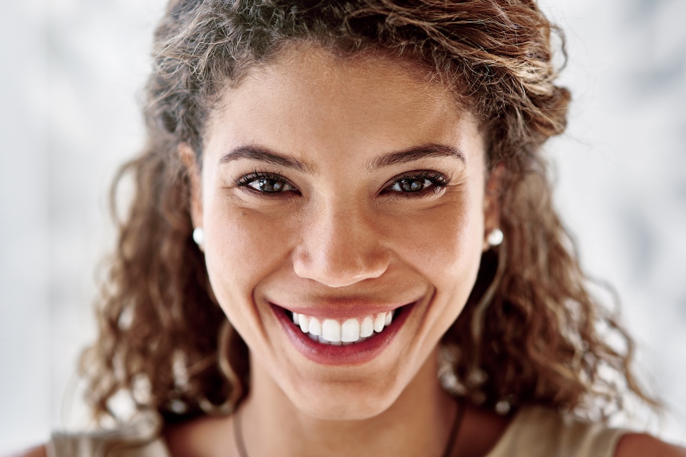 fixing shipped teeth in Carmel with cosmetic bonding