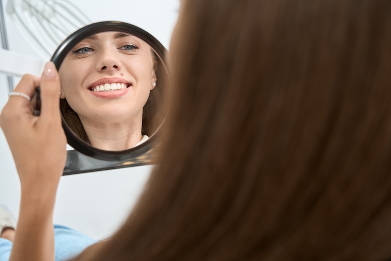 Carmel smile makeover