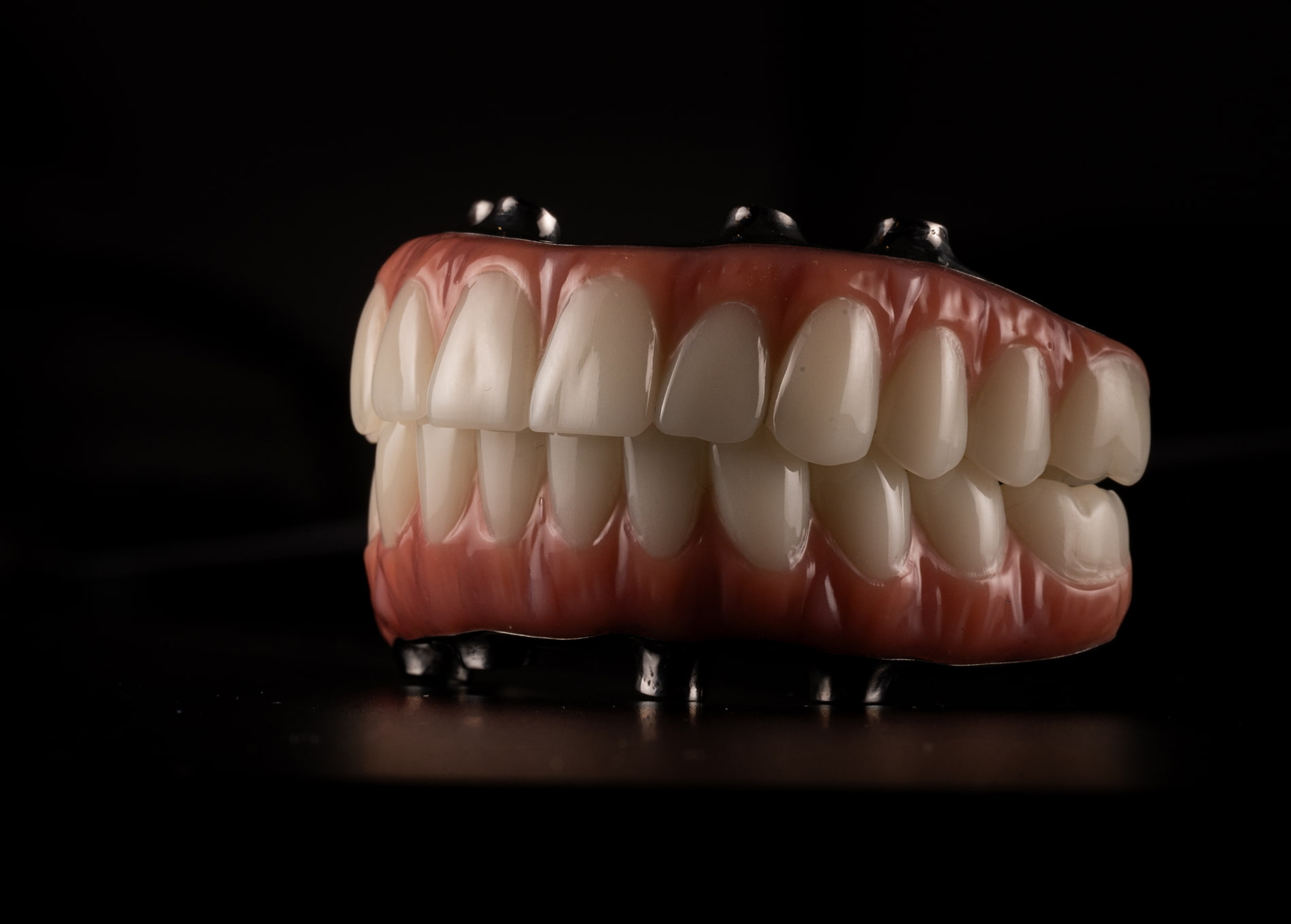 full mouth dental implants in Carmel
