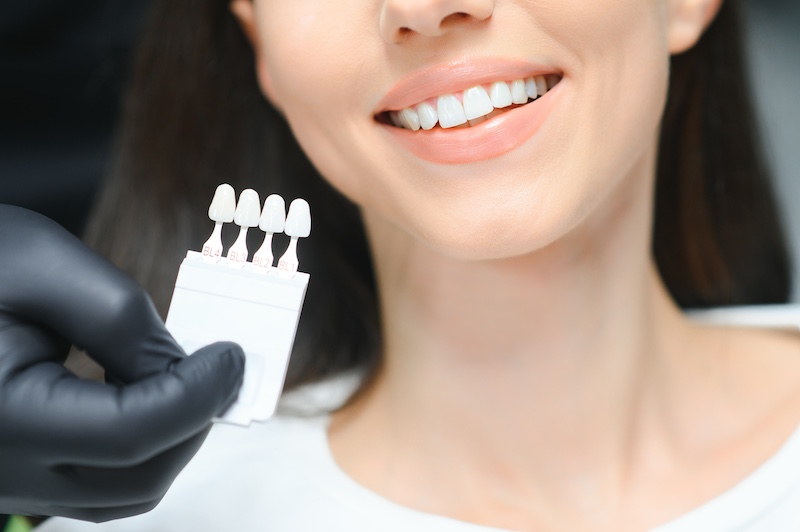 5 Best Cosmetic Dentists for Dental Veneers in Rock Hill SC (2026)
